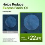 Anua Azelaic Acid 10 Hyaluron Redness Soothing Serum, Facial Serum for Blemish-Prone & Oily-Prone Skin, Lightweight & Hydrating Blemish Care, Hyaluronic Acid, Korean Skincare, 1.01 fl oz. - Image 8