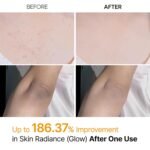 Dr.Melaxin Peel Shot Kojic Acid Turmeric Body Exfoliator Spray 6.76 fl.oz - AHA PHA Niacinamide Body Scrub for KP Bumps, Dark Spots, Uneven Skin Tone, Dead Skin, Korean Skin Care - Image 4