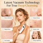 Blackhead Remover Vacuum for Face, 3 Adjustable Suction Levels, White | Adjustable Pore Cleaning, 5 Interchangeable Probes, USB Rechargeable Design - Image 9