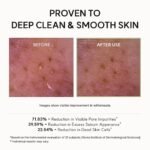 Arencia Korean Rice Mochi Face Cleanser - Face Wash, Gentle Scrub All in One for Deep Cleansing, Moisturizing, Pore Minimizing with Rice Water & Green Tea (4.23oz) - Image 8