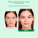 Dark Spot Remover for Face & Body, Lightweight Corrector Serum | Targets Stubborn Hyperpigmentation, Sun Damage & Acne Marks. Fast-Absorbing Non-Greasy Texture. Gentle Daily Formula. - Image 3