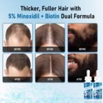 5% Minoxidil with Biotin for Men and Women – Hair and Beard Regrowth Serum, Unisex, Gentle, 2-Pack (Total 4.06 fl oz) - Image 3