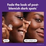 Mighty Patch Hero Cosmetics for Dark Spots Post-Blemish Patch, 8 Ct | Acne Patch with 395 Micropoints, Formulated With Vitamin C, Niacinamide; Dermatologist Tested; Non-Irritating - Image 4