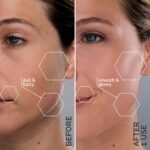 SPA SCIENCES - SIMA Patented Dermaplane Razor for Women Face | Painless 2-in-1 Facial Exfoliation & Peach Fuzz Hair Removal, Anti-Aging, 3 Speeds, Rechargeable, 19 Weeks Treatment - Image 5