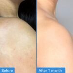 Good Molecules Discoloration Correcting Body Treatment, 4 fl oz | Body treatment that improves the appearance of dark spots and discoloration on arms, legs, and body. - Image 4
