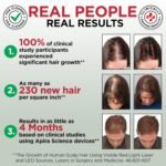 GroWell Red Light Therapy Hair Growth Cap – FDA Cleared Laser Treatment for Hair Regrowth and Reduced Shedding – LED & Laser Red Light Therapy Clinically Proven in Double-Blind Studies -Black - Image 6