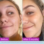 Good Molecules Niacinamide Brightening Toner with Arbutin, 4 fl oz | Brightens and evens the look of skin tone, refines texture, and minimizes the look of pores. - Image 7