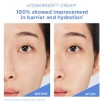 AESTURA ATOBARRIER365 Cream with Ceramides, Korean Face Moisturizer for Barrier Repair | 120H lasting Hydration, Ceramide Capsules, Dry & Sensitive Skin, Non-comedogenic, 80 mL / 2.70 fl.oz. - Image 8
