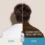 KMS HeadRemedy Deep Cleanse Shampoo | Scalp Purifying, 300 ml - Image 4