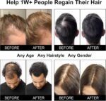 Laser Hair Growth Cap, Red Light Therapy Cap for Hair Regrowth, Blue Light Hair Care for Reduce Hair Loss in Men and Women - Image 7