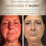 The OMG Blaster 5-in-1 Face Lifting Tool by Ashley Black. Patented Technology for Fine Lines, Wrinkles, Skin Tightening, Face Contouring, Lymphatic Darinage and Temporary Blood Flow - Image 5