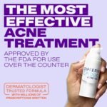 Differin Epiduo Acne Gel Treatment, Adapalene & Benzoyl Peroxide, 45g Pump | FDA-Approved OTC Acne Gel, Adapalene 0.1% + Benzoyl Peroxide 2.5%, Clears & Prevents Breakouts, Strongest OTC, 90 Day Supply - Image 4