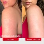 First Aid Beauty KP Bump Eraser Body Scrub with 10% AHA - Dermatologist-Tested Keratosis Pilaris Exfoliator - Support for Rough Bumps, Uneven Skin Texture & Strawberry Skin - Sensitive Skin - Image 5