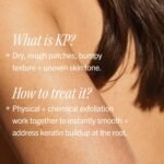 First Aid Beauty KP Bump Eraser Body Scrub with 10% AHA - Dermatologist-Tested Keratosis Pilaris Exfoliator - Support for Rough Bumps, Uneven Skin Texture & Strawberry Skin - Sensitive Skin - Image 6