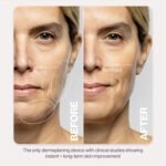 DERMAFLASH LUXE+ Sonic Dermaplaning Tool for Face Peach Fuzz Removal, Anti-Aging and Exfoliation - Image 7
